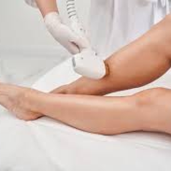 Triệt lông 1/2 chân