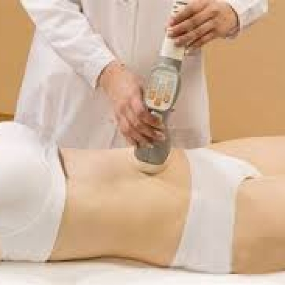 Triệt lông bụng