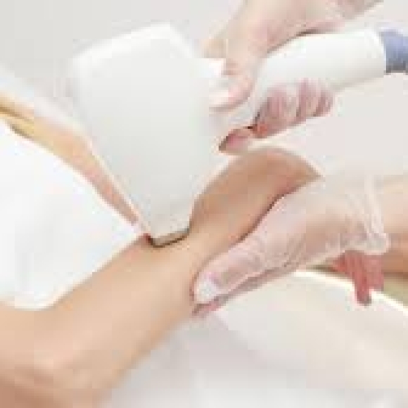 Triệt lông full tay 