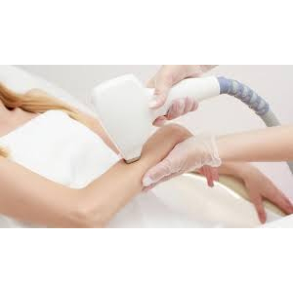 Triệt lông full tay 